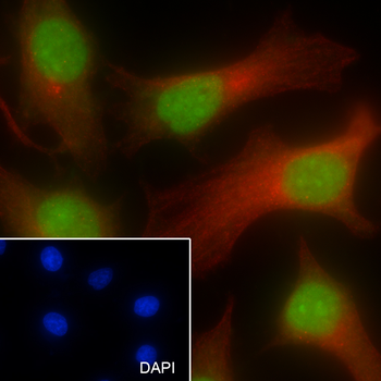 XRCC5 Recombinant Mouse Monoclonal Antibody