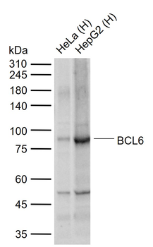 BCL6 Recombinant Rabbit Monoclonal Antibody