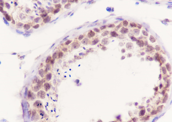 Oct6 Recombinant Rabbit Monoclonal Antibody