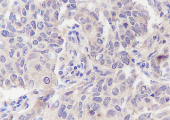 PRMT5 Recombinant Rabbit Monoclonal Antibody