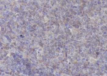 HLA-E Recombinant Mouse Monoclonal Antibody