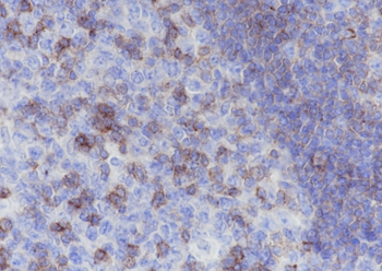 CD50 Recombinant Rabbit Monoclonal Antibody