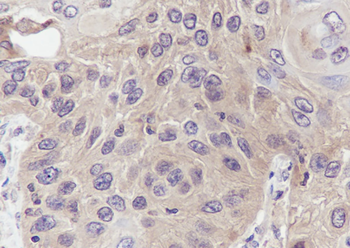 STRAP Recombinant Mouse Monoclonal Antibody