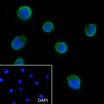 PLEK Recombinant Mouse Monoclonal Antibody