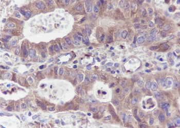 PLEK Recombinant Mouse Monoclonal Antibody