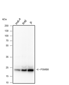 PSMB8 Recombinant Mouse Monoclonal Antibody