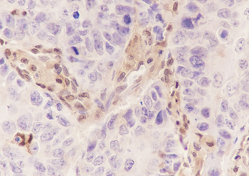 PSMB8 Recombinant Mouse Monoclonal Antibody