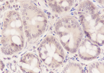 PSMB8 Recombinant Mouse Monoclonal Antibody