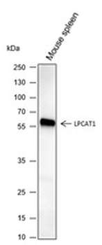 LPCAT1 Recombinant Mouse Monoclonal Antibody