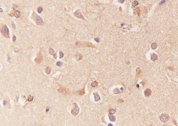 APOE Recombinant Mouse Monoclonal Antibody