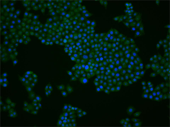 TET2 Rabbit Polyclonal Antibody