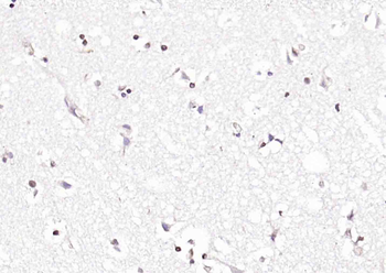 TET2 Rabbit Polyclonal Antibody