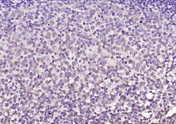 TET2 Rabbit Polyclonal Antibody