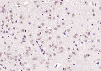 TET2 Rabbit Polyclonal Antibody