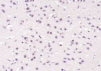 TET2 Rabbit Polyclonal Antibody