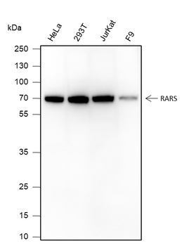RARS Recombinant Mouse Monoclonal Antibody