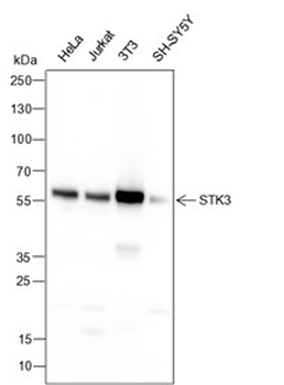 STK3 Recombinant Mouse Monoclonal Antibody