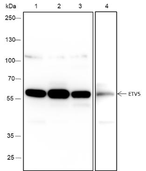 ETV5 Recombinant Mouse Monoclonal Antibody