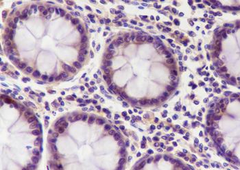 PIK3R2 Recombinant Mouse Monoclonal Antibody