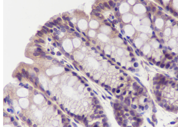 PIK3R2 Recombinant Mouse Monoclonal Antibody