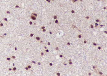HRPT2 Recombinant Mouse Monoclonal Antibody