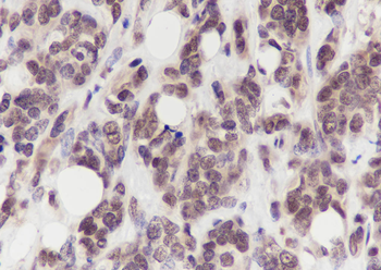 HRPT2 Recombinant Mouse Monoclonal Antibody