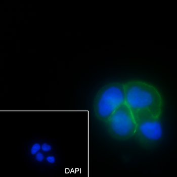 TROP2 Recombinant Rabbit Monoclonal Antibody