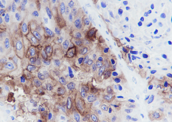 TROP2 Recombinant Rabbit Monoclonal Antibody