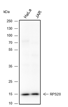 RPS20 Recombinant Rabbit Monoclonal Antibody