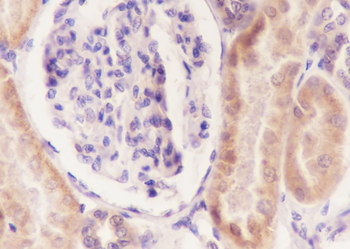 RPS20 Recombinant Rabbit Monoclonal Antibody