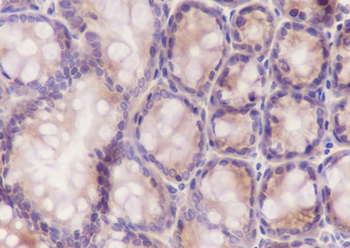 RPS20 Recombinant Rabbit Monoclonal Antibody