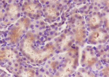 RPS20 Recombinant Rabbit Monoclonal Antibody