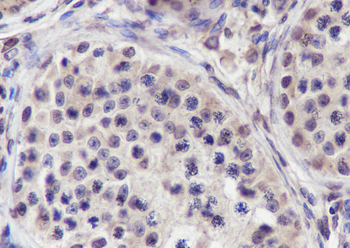 NUP62 Recombinant Mouse Monoclonal Antibody