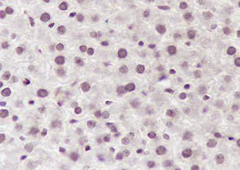 NUP62 Recombinant Mouse Monoclonal Antibody