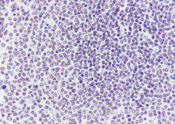 TDP-43 Recombinant Mouse Monoclonal Antibody