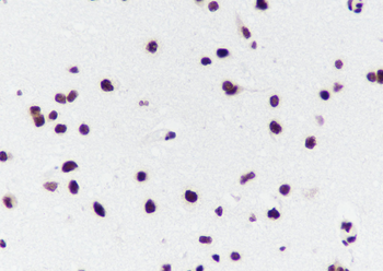 TDP-43 Recombinant Mouse Monoclonal Antibody