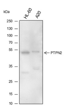PTPN2 Recombinant Mouse Monoclonal Antibody