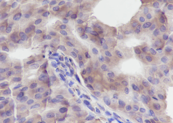 PTPN2 Recombinant Mouse Monoclonal Antibody