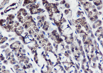 PTPN2 Recombinant Mouse Monoclonal Antibody