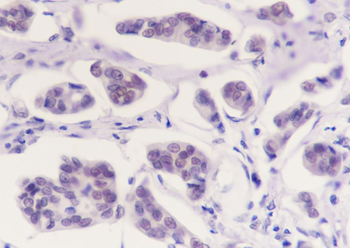 BAG6 Recombinant Mouse Monoclonal Antibody