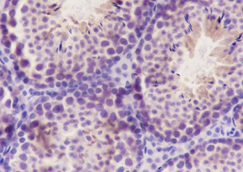 BAG6 Recombinant Mouse Monoclonal Antibody