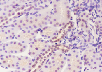 BAG6 Recombinant Mouse Monoclonal Antibody