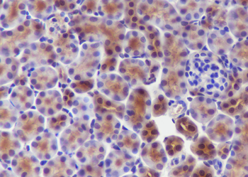 UBC12 Recombinant Mouse Monoclonal Antibody