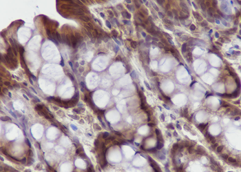 UBC12 Recombinant Mouse Monoclonal Antibody