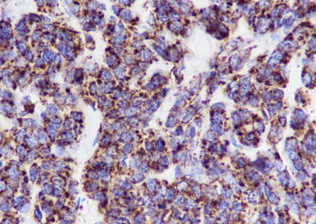 GRP75 Recombinant Mouse Monoclonal Antibody