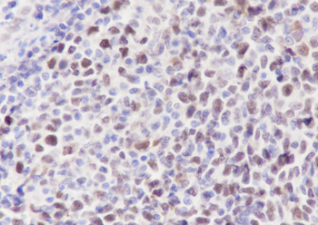 MCM5 Recombinant Rabbit Monoclonal Antibody