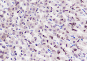 MCM5 Recombinant Rabbit Monoclonal Antibody