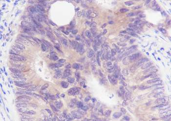 SETBP1 Recombinant Rabbit Monoclonal Antibody