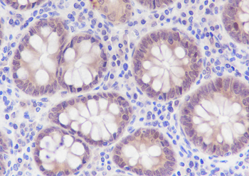 SETBP1 Recombinant Rabbit Monoclonal Antibody