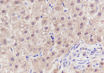 SETBP1 Recombinant Rabbit Monoclonal Antibody